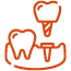 Icon Implantes Dentales